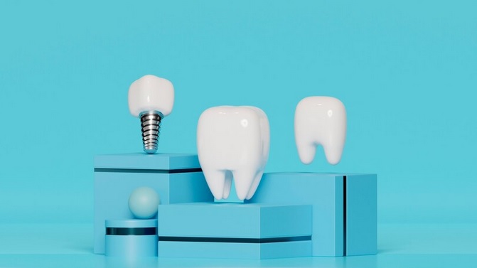Види зубних імплантів у сучасній стоматології та методика їх встановлення