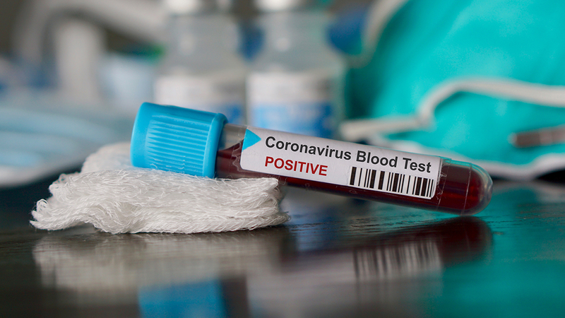 В Харьковской области - 5 новых случаев коронавируса, всего - 82