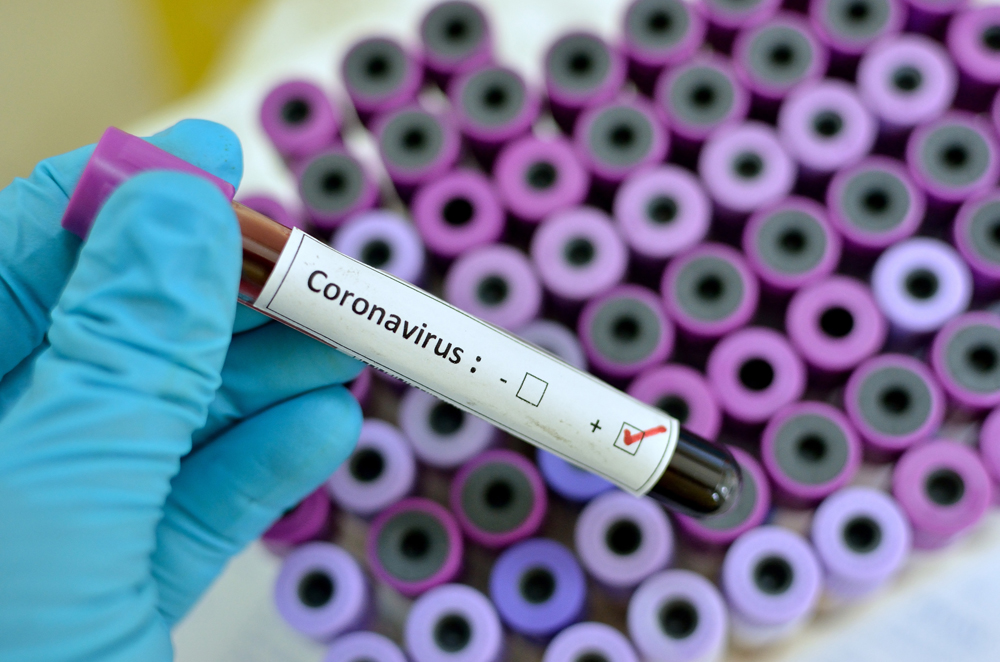 В Харькове - первый случай коронавируса