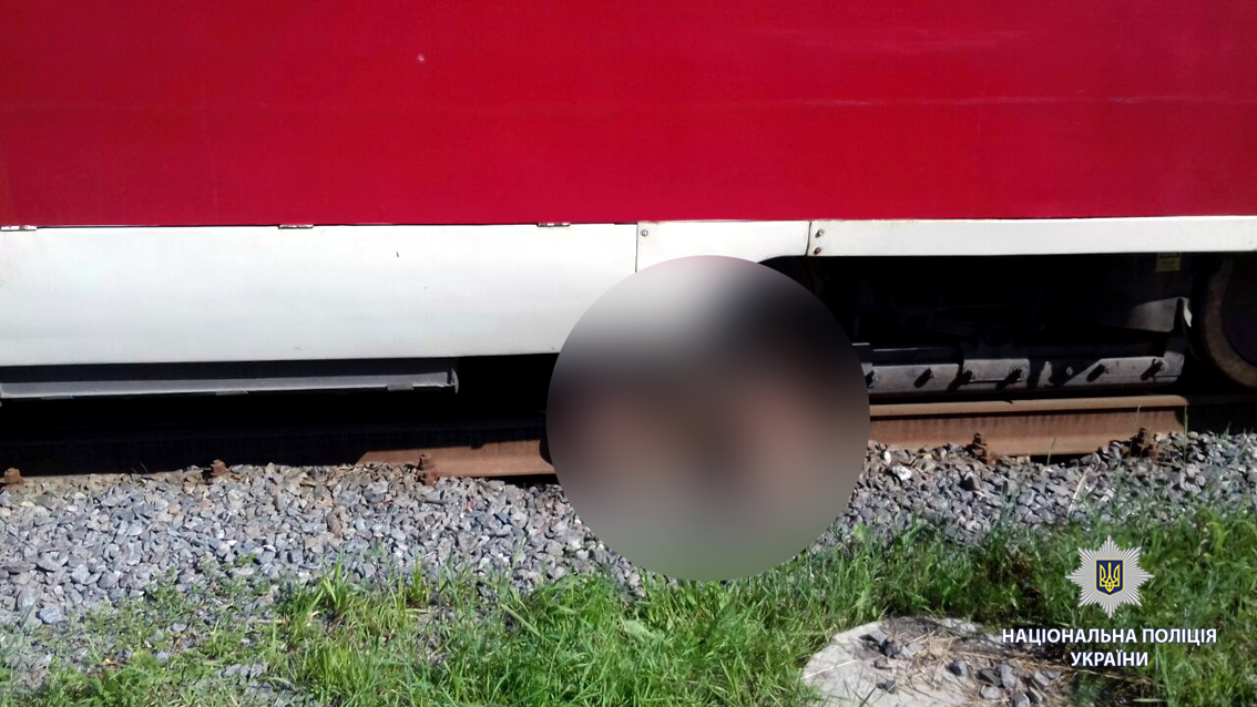 Мужчине, который бросился под трамвай, ампутировали ноги (фото)