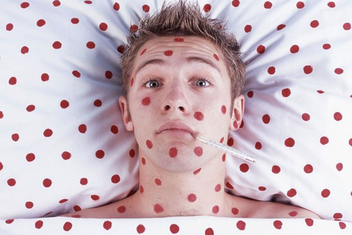 Такого количества больных корью студентов еще не было - главврач студбольницы