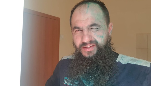 В Харькове облили зеленкой сепаратиста