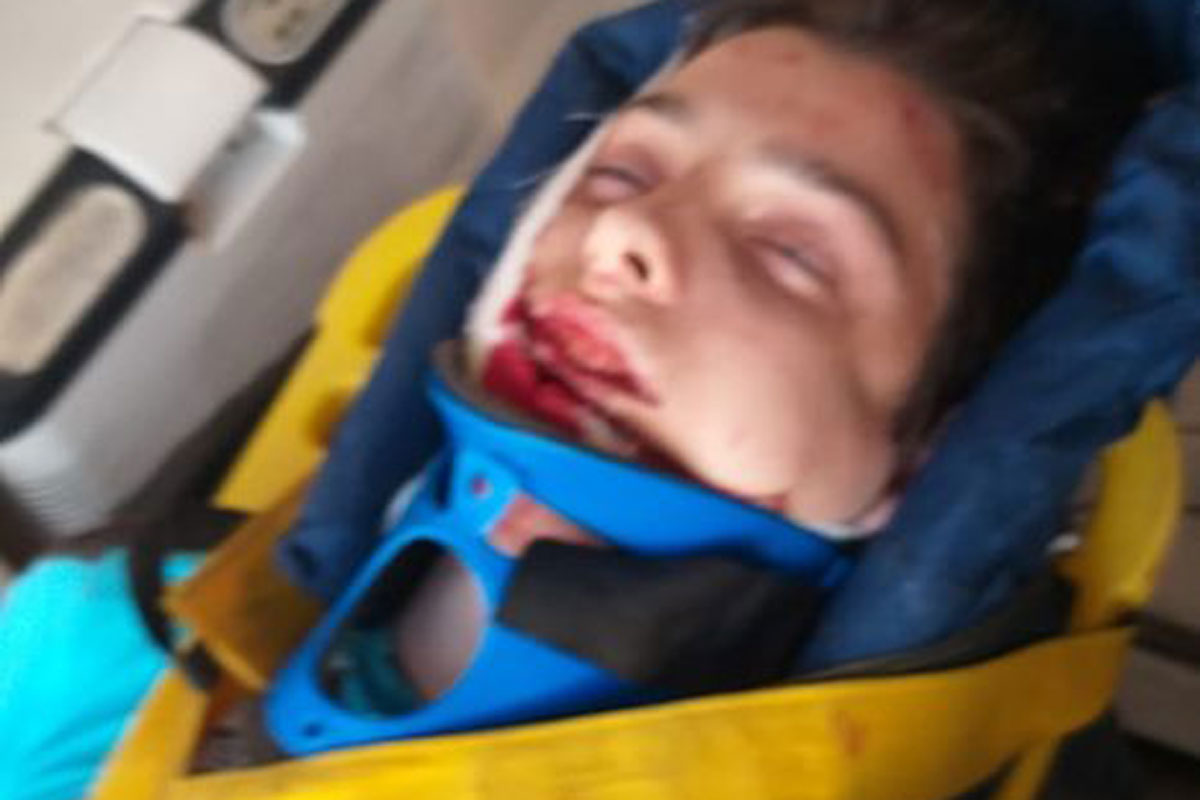 В Харькове ребенок упал с моста: подробности (фото)