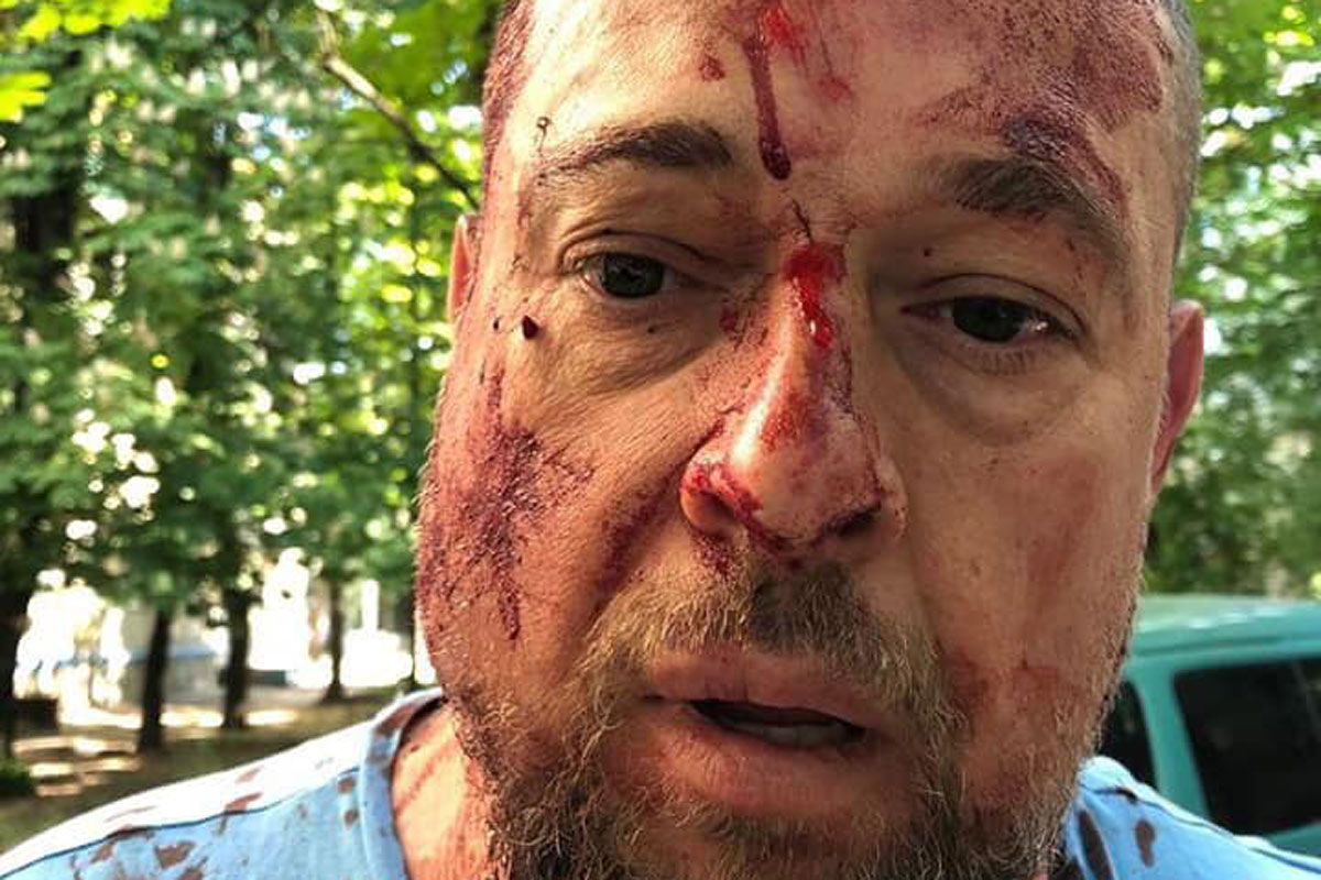 В Харькове избили активиста (фото - 18+)