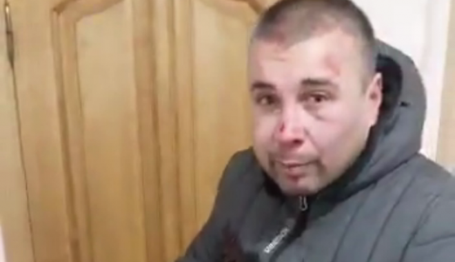 В Харькове напали на директора парка "Юность" (видео)