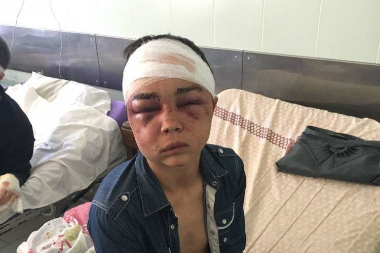 На Рогани 17-летнего парня подвергли зверским пыткам (фото 18+)