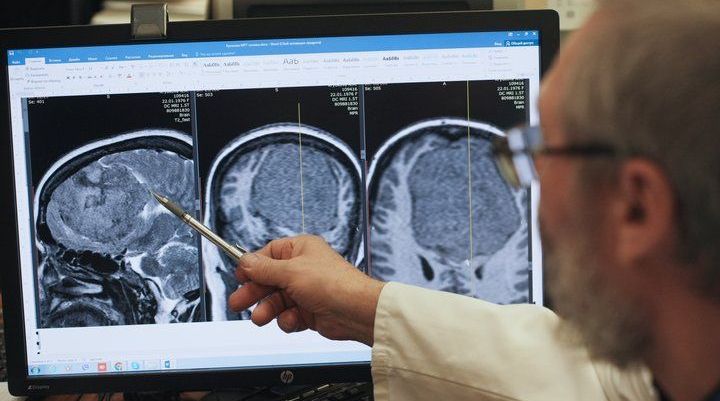 В Харькове не работает отделение нейрохирургии Института неврологии: операций ждут 250 пациентов