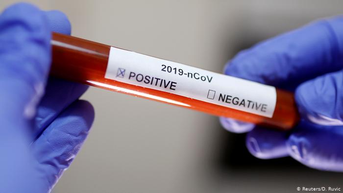 Украина будет сама производить тесты на коронавирус - Минздрав